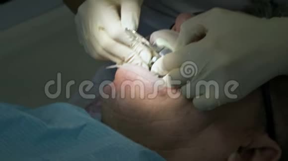 女牙医带着助手检查病人一个老人的嘴高级关键专业工作视频的预览图