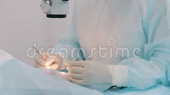 一位医生正在用医疗工具做视力手术视频的预览图