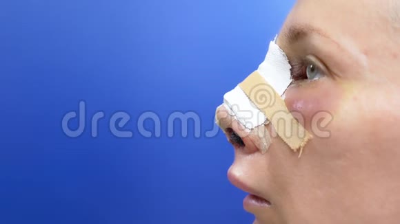 现实形象鼻成形术后第二天女性面部视频的预览图