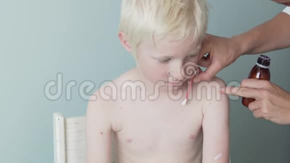 医生给生病的孩子涂抹药膏视频的预览图