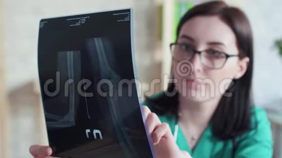 女医生看着X光照片视频的预览图