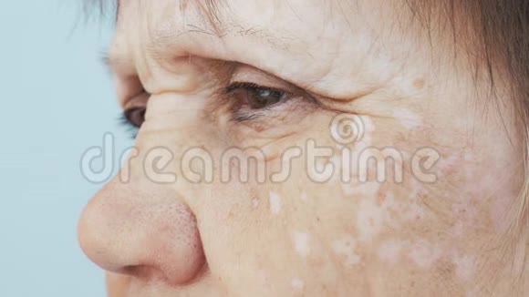 一位老年妇女面部有斑点的肖像视频的预览图