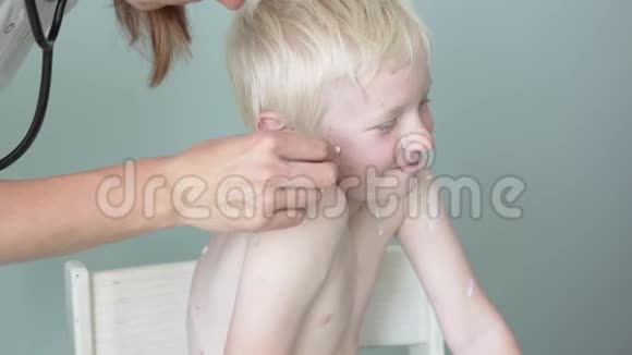 医生治疗一个患水痘的孩子的伤口视频的预览图
