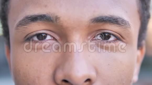 非洲男人的眨眼睛视频的预览图