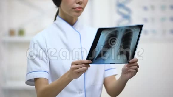 女医师仔细检查肺部x线支气管炎风险健康视频的预览图