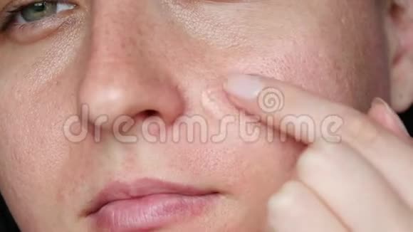 女脸的特写女孩化妆乳霜血清或治疗痤疮问题皮肤和护理视频的预览图