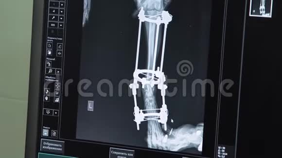 医生在医院看X光视频的预览图