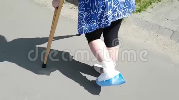 一个穿着白色医用石膏的腿断的女人拄着拐杖跳起来一个成年人的生活困境有限流动视频的预览图