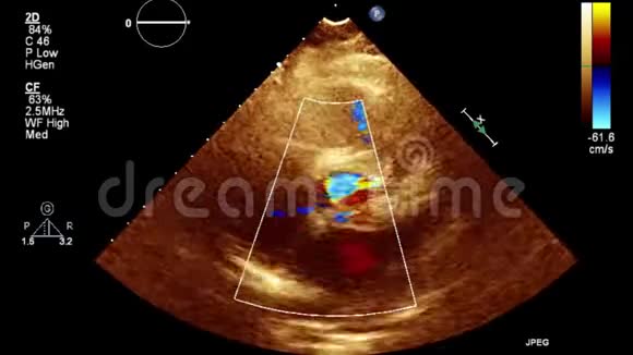 经食管超声检查心脏图像视频的预览图