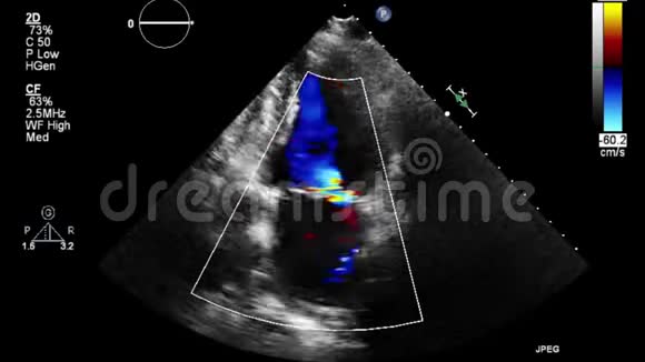 经食管超声检查心脏图像视频的预览图
