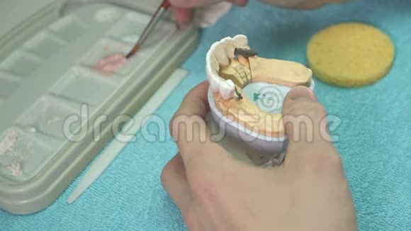 牙科技师做牙齿种植视频的预览图