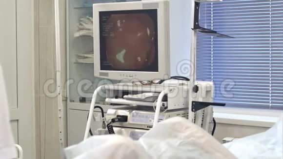 外科医生在内镜检查时看着监视器视频的预览图