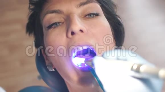 牙科医生在牙科诊所里用蓝色照射病人的嘴视频的预览图