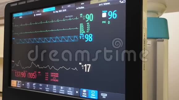 医院的医疗保健监测设备EKG平板心率监测屏幕心电图视频的预览图