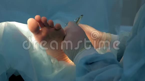 外科医生在手术后用可吸收的线缝合腿部脚踝的伤口视频的预览图