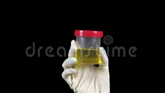 尿液在一个测试罐特写医生把一个罐子装在一个黑色背景的手套里视频的预览图