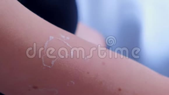 女人的皮肤从紫外线晒伤腿和腹部特写视频的预览图