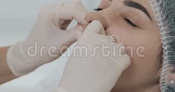 美容医生的手在隆唇后按摩病人嘴唇关门视频的预览图