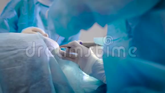 牙医在牙科诊所做手术病人在全麻下躺在桌子上视频的预览图