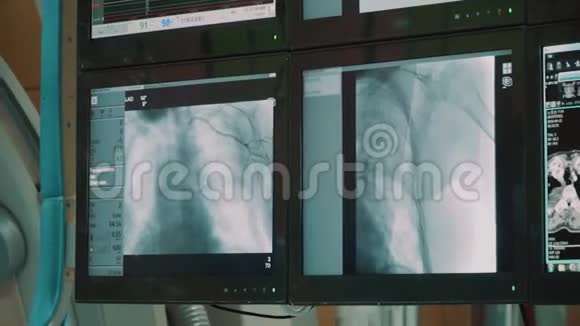 现代医疗手术室医生可以在手术室内查看带有生物识别数据的监视器视频的预览图