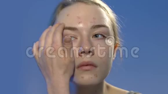 有粉刺皮肤的年轻女士涂抹粉底霜渴望美丽视频的预览图