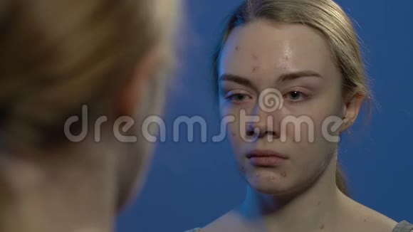 年轻的哭泣女孩看着镜子里的痤疮患有皮肤问题视频的预览图