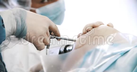 手术期间外科医生团队用外科腹腔镜器械在膝盖上进行手术医学外科视频的预览图