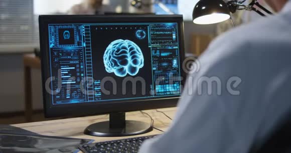 医生分析X光和脑部扫描视频的预览图
