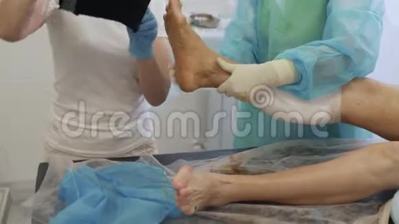 医生和护士在硬化治疗术后用专用工具对病人腿部进行压缩放养视频的预览图