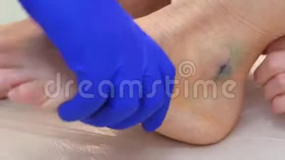 外科医生在手术后弯曲和松开病人的腿检查脚踝的移动性视频的预览图