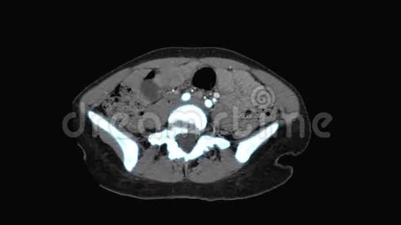 磁共振扫描仪显示医学X线成像视频的预览图