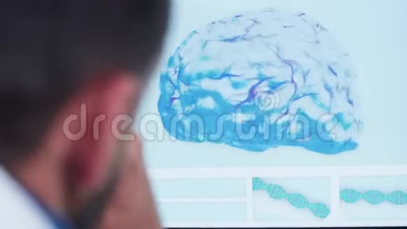 医生近距离观察3D大脑模型视频的预览图