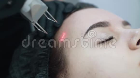 在激光面部剥离过程中关闭年轻女性面部的一部分慢动作视频的预览图