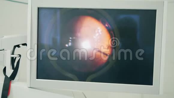手术时用眼睛显示电脑视频的预览图