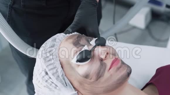 贴身美容师在临床上对年轻女性面部进行碳剥离术动作缓慢视频的预览图