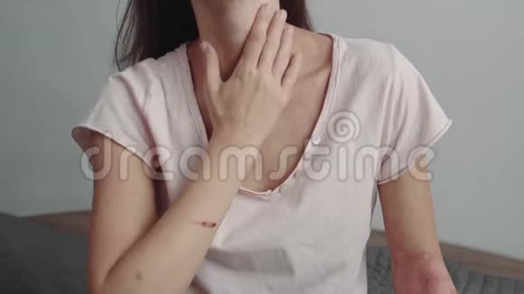 颈部过敏性皮炎视频的预览图