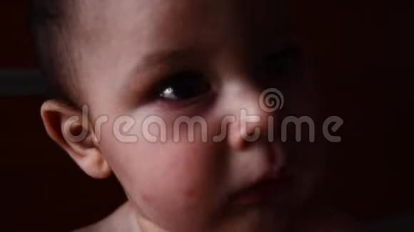 近距离拍摄六个月大的婴儿脸上有蚊子叮咬试图接触照相机视频的预览图