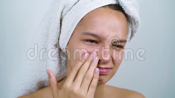 穿浴巾的少女对自己的问题皮肤不满意视频的预览图