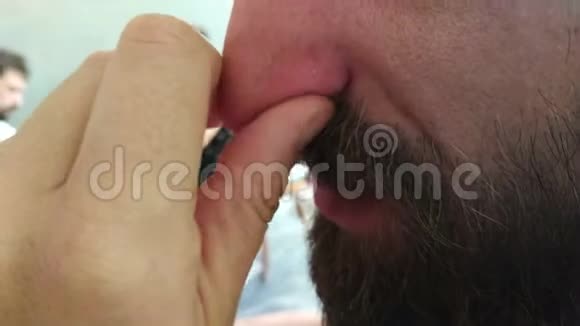 思考男人揉鼻子皮肤科感染概念视频的预览图