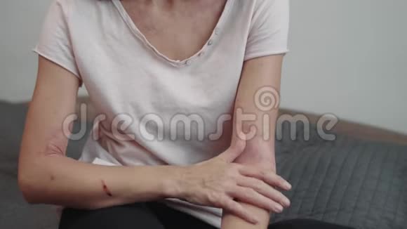 手臂上的特应性皮炎视频的预览图