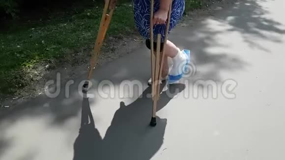 体重过大的女人是单腿和拐杖第二条腿断了石膏固定在脚上视频的预览图