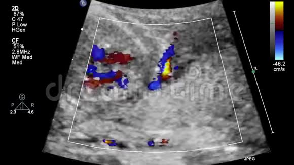 胎心超声检查视频的预览图