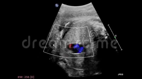 胎心超声检查视频的预览图