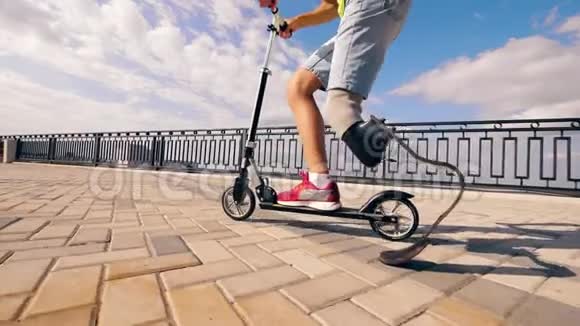 一个腿上有替代品的人正在骑滑板车视频的预览图