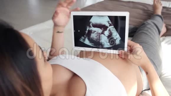 美丽的年轻孕妇躺在床上用数字平板电脑看婴儿的超声波视频的预览图