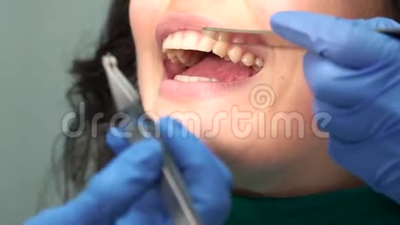 牙齿和支架视频的预览图