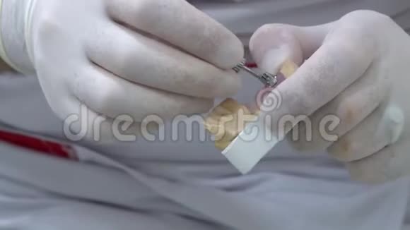 牙医尝试植入物2视频的预览图