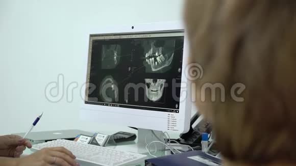 牙科诊所监视器上的x光视频的预览图
