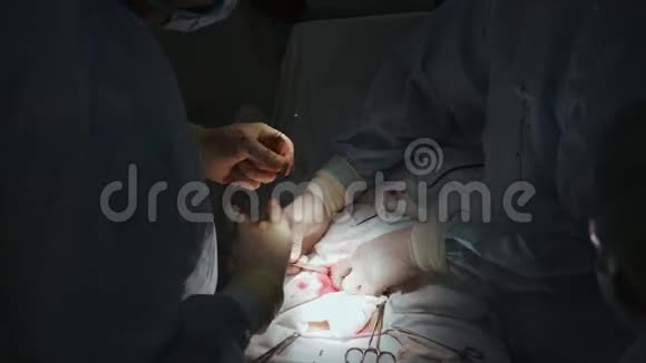 外科医生做手术时腹部有开放性伤口医生使用医用手术刀和夹子视频的预览图