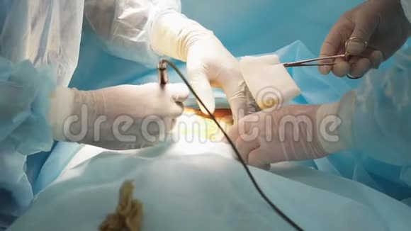 整形手术美容外科手术组视频的预览图